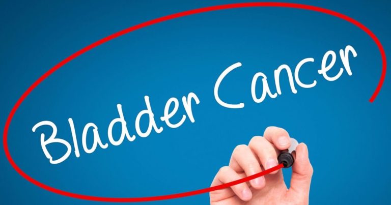 8 Symptoms Of Bladder Cancer You May Not Know